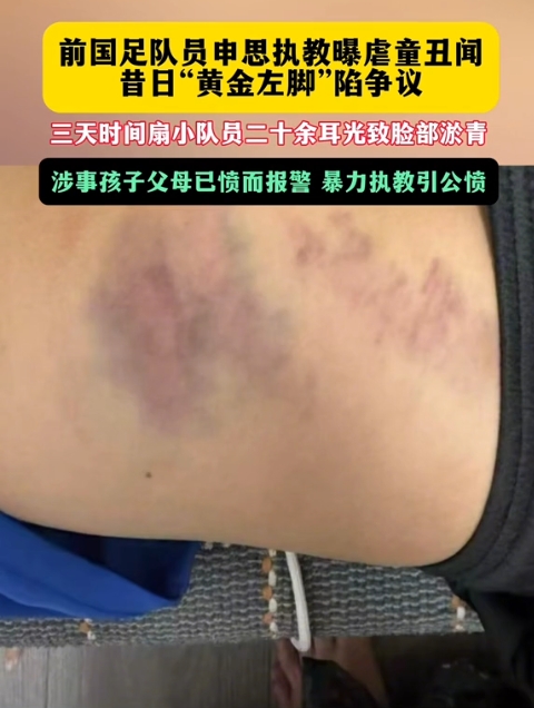 前国脚申思训练中连续掌掴小球员，家长已报警